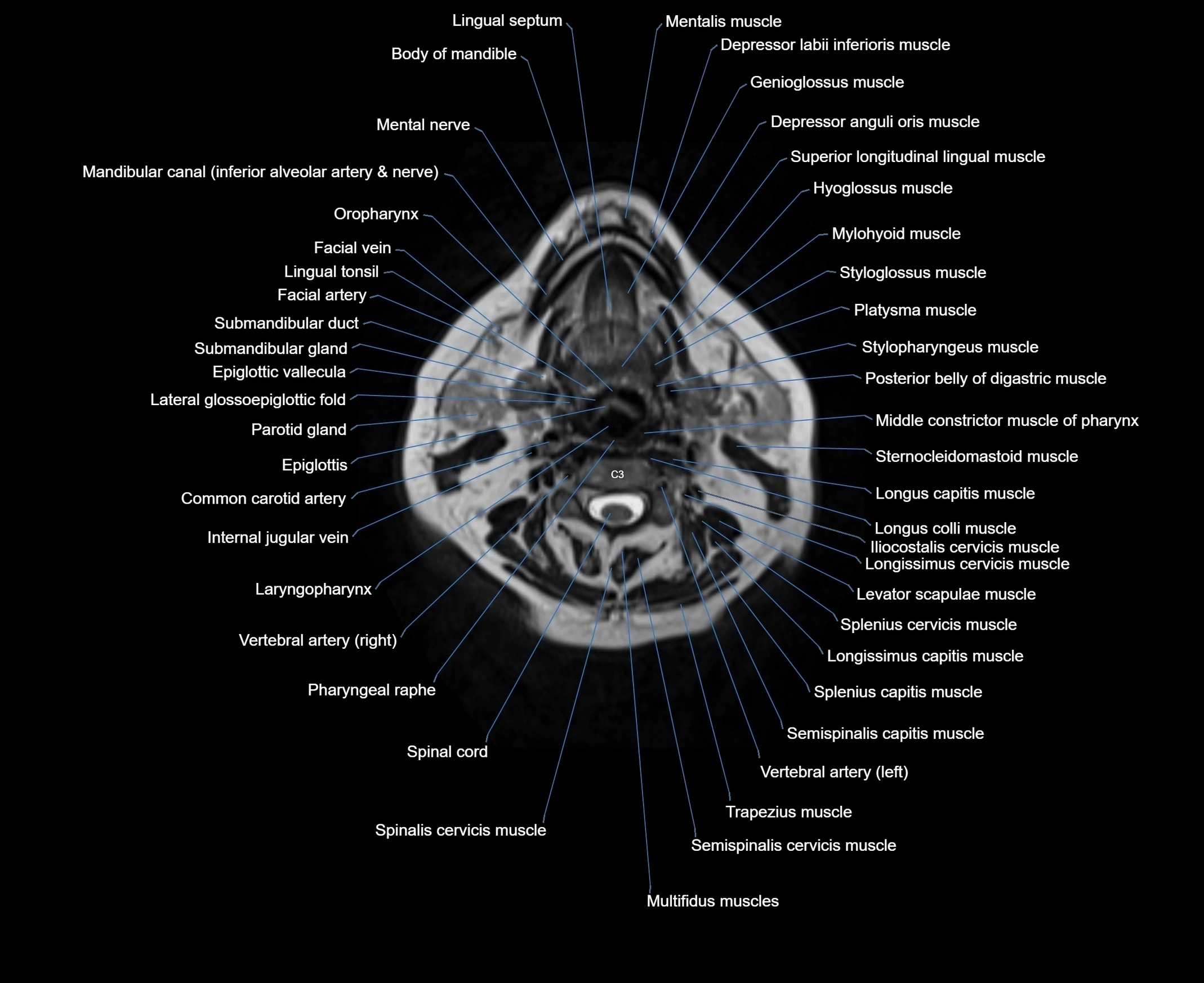 MRI Neck 3D labelled cross section anatomy axial 3t image-00001-00043.webp